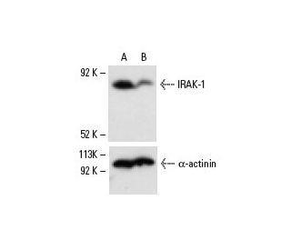 western blotting image from recommended IRAK-1 (F-4) monoclonal antibody replacement. Image 6849