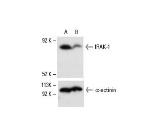 IRAK-1 siRNA (h): sc-35704. Western blot analysis of IRAK-1 expression in non-transfected control (A) and IRAK-1 siRNA tra 