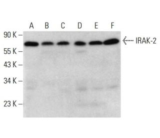 IRAK-2 Antibody (D-8) - Western Blotting - Image 381780 