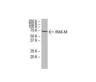 IRAK-M Antibody (XX-6) - Western Blotting - Image 33765 