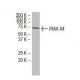 IRAK-M Antibody (XX-6) - Western Blotting - Image 33765 