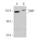 IRBP Antibody (H-6) - Western Blotting - Image 360782