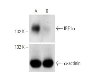 IRE1a CRISPR/Cas9 KO Plasmid (h): sc-400576. Western blot analysis of human IRE1a expression in empty vector control (A) aEach CRISPR/Cas9 Knockout (KO) Plasmid product consists of a pool of 3 plasmids designed to ensure identification and cleavage of a specific gene for maximum knockout efficiency. Each plasmid encodes a unique 20 nt sequence derived from the GeCKO (v2) library.