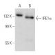 western blotting image from recommended IRE1α (B-12) monoclonal antibody replacement. Image 353682