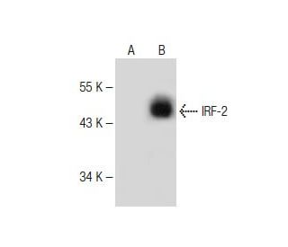 western blotting image from recommended IRF-2 (G-10) monoclonal antibody replacement. Image 149987