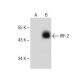 western blotting image from recommended IRF-2 (G-10) monoclonal antibody replacement. Image 149987