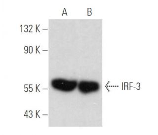 western blotting image from recommended IRF3 (SL-12) monoclonal antibody replacement. Image 360460