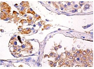 sabp様 FOXP3 Antibody (F-9) | SCBT - Santa Cruz Biotechnology
