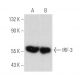 western blotting image from recommended IRF3 (SL-12) monoclonal antibody replacement. Image 360460