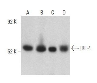 western blotting image from recommended IRF-4 (F-4) monoclonal antibody replacement. Image 398865