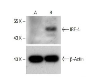 IRF-4 CRISPR Activation Plasmid (h): sc-400288-ACT. Western blot analysis of IRF-4 expression in non-transfected control (Each CRISPR/Cas9 Knockout (KO) Plasmid product consists of a pool of 3 plasmids designed to ensure identification and cleavage of a specific gene for maximum knockout efficiency. Each plasmid encodes a unique 20 nt sequence derived from the GeCKO (v2) library.