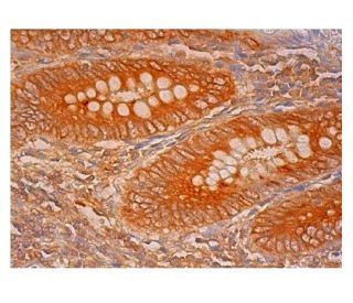 IRF-5 Antibody (C-6) - Immunohistochemistry - Image 302526 