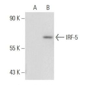 IRF-5 Antibody (10T1) - Western Blotting - Image 82466Each CRISPR/Cas9 Knockout (KO) Plasmid product consists of a pool of 3 plasmids designed to ensure identification and cleavage of a specific gene for maximum knockout efficiency. Each plasmid encodes a unique 20 nt sequence derived from the GeCKO (v2) library.