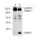 Irinotecan hydrochloride trihydrate: sc-202186. Western blot analysis of cleaved PARP-1 expression in untreated (A) and Ir