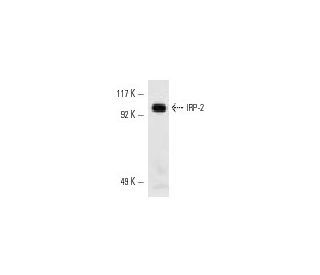 western blotting image from recommended IRP-2 (7H6) monoclonal antibody replacement. Image 10606