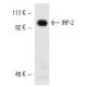 western blotting image from recommended IRP-2 (7H6) monoclonal antibody replacement. Image 10606