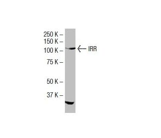 IRR Antibody (I-63) - Western Blotting - Image 33677 