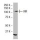 IRR Antibody (I-63) - Western Blotting - Image 33677 