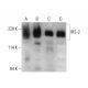 western blotting image from recommended IRS-2 (B-5) monoclonal antibody replacement. Image 376846