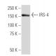 IRS-4 Antibody (RI-7) - Western Blotting - Image 34226 