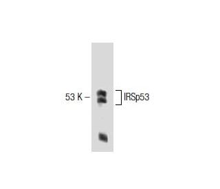 IRSp53 Antibody (46) - Western Blotting - Image 138258 