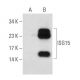 ISG15 Antibody (3E5) - Western Blotting - Image 73088