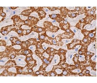 ISG15 Antibody (F-9) - Immunohistochemistry - Image 382983 