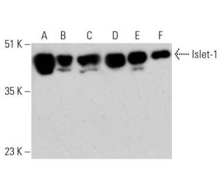 western blotting image from recommended Islet-1 (B-1) monoclonal antibody replacement. Image 387998