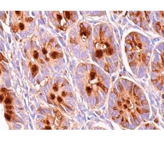 immunohistochemistry image from recommended ITF (B-1) monoclonal antibody replacement. Image 377193