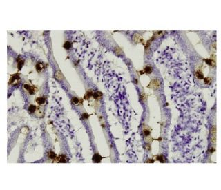 ITF Antibody (H-425) - Immunohistochemistry - Image 35945