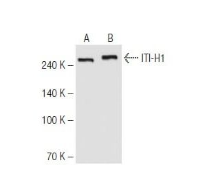 ITI-H1 Antibody (40B10) - Western Blotting - Image 62801
