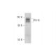 ITI-H4 Antibody (A-12) - Western Blotting - Image 344606