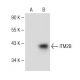ITM2B Antibody (H-11) - Western Blotting - Image 149501