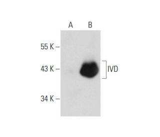 IVD Antibody (B-9) - Western Blotting - Image 131694 