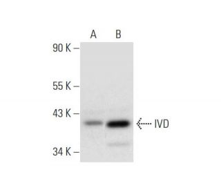 IVD Antibody (B-9): sc-271205