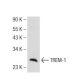 J774.A1 Cell Lysate: sc-3802. Western blot analysis of TREM-1 expression...