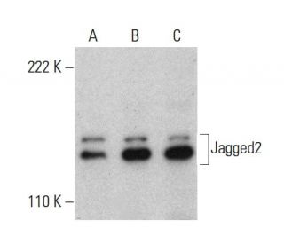 western blotting image from recommended Jagged2 (F-4) monoclonal antibody replacement. Image 380985