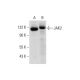 Este anticuerpo policlonal ha dejado de fabricarse. Consulta nuestro anticuerpo monoclonal recomendado <a href="jak2-antibody-c-10">JAK2 (C-10)</a> (se muestran datos de muestra). western blotting image from recommended JAK2 (C-10) monoclonal antibody replacement. Image 320285