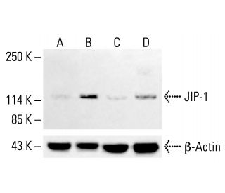 JIP-1 Antibody (2J8) - Western Blotting - Image 413096Each CRISPR/Cas9 Knockout (KO) Plasmid product consists of a pool of 3 plasmids designed to ensure identification and cleavage of a specific gene for maximum knockout efficiency. Each plasmid encodes a unique 20 nt sequence derived from the GeCKO (v2) library. 