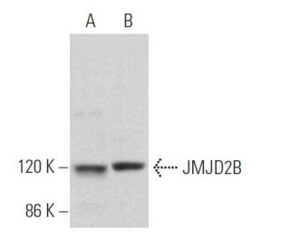 JMJD2B Antibody (F-12) - Western Blotting - Image 364057The Double Nickase Plasmid features a U6 promoter for sgRNA expression, a 20 nt targeting sequence, and a gRNA scaffold to guide Cas9n. It includes a CBh promoter for Cas9n (D10A) and puromycin resistance, GFP for transfection verification, and nuclear localization signals (NLS). The 2A peptide allows co-expression of Cas9n and Puro from a single promoter, enabling precise genome editing with reduced off-target effects.