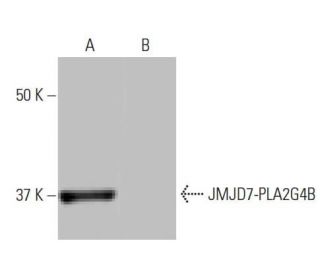 JMJD7 Antibody (11K2) - Western Blotting - Image 64952