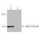 JMJD7 Antibody (11K2) - Western Blotting - Image 64952