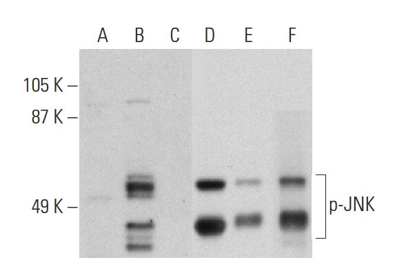 JNK Antibody (D-2) | SCBT - Santa Cruz Biotechnology