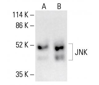 その他 dnk jnk-antibody-d-2-western-