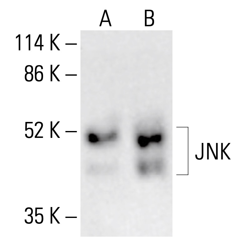 JNK抗体(D-2) | SCBT - Santa Cruz Biotechnology JNK抗体(D-2) | SCBT - Santa Cruz Biotechnology