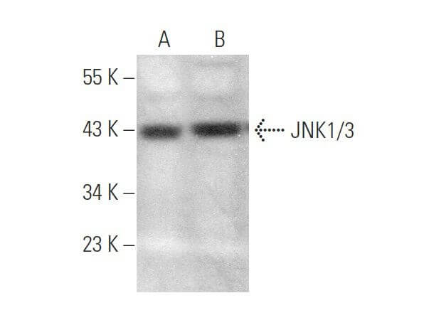 Kページ Troponin I Antibody (C-4) | SCBT - Santa Cruz Biotechnology