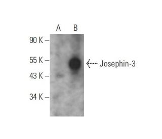 Josephin-3 Antibody (C-3) - Western Blotting - Image 344312