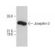 Josephin-3 Antibody (G-12) - Western Blotting - Image 375592