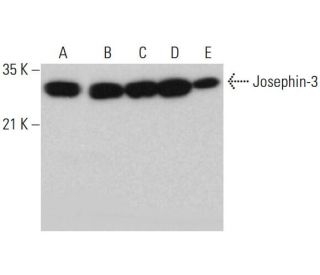 Josephin-3 Antibody (G-12) - Western Blotting - Image 376137 