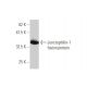 Junctophilin-1 Antibody (2E6) - Western Blotting - Image 350240